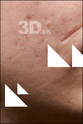 Casey Schneider HD Face Skin