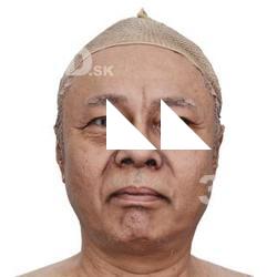 Uchida Tadao Raw Head Scan