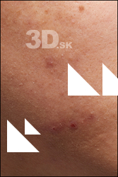  HD Face Skin Fukuyama Bakin 