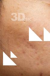  HD Face Skin Lan 