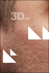  HD Face Skin Shawn Jacobs 