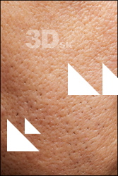  HD Face Skin Jacobo Andino 