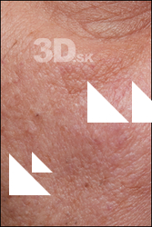  HD Face Skin Owen Martin 
