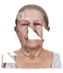 Aimee Morgan Raw Head Scan