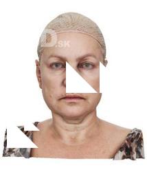 Ellie Lane Raw Head Scan