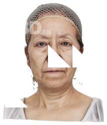 Go Wakiko Raw Head Scan