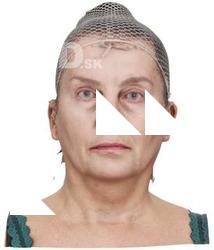 Isolda Hoven Raw Head Scan