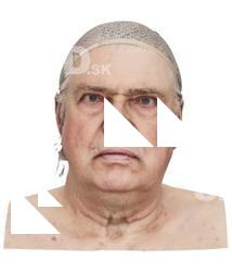 Joachim Groom Raw Head Scan