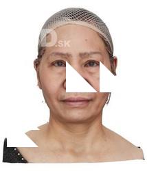 Yoshimi Inaho Raw Head Scan