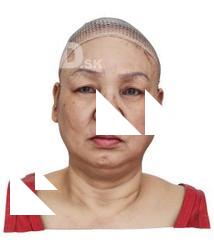 Yoshimoto Rin Raw Head Scan