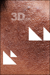  HD Face Skin Enoch Gorat 