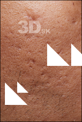  HD Face Skin Kodena Haelazar 