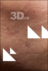  HD Face Skin Darren 