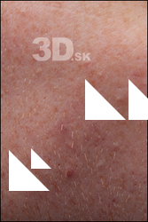  HD Face Skin Fergal 