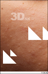  HD Face Skin Umaira 