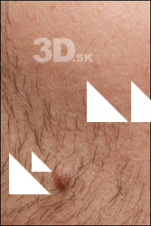  HD Face Skin Arvid 