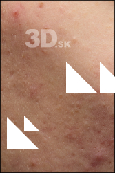 HD Face Skin Bryton 