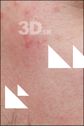  HD Face Skin Sigvid 