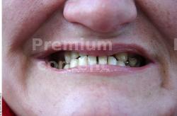 Teeth Woman White Average