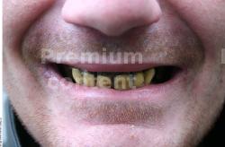 Teeth Man White Average