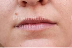 Mouth Woman White Birthmarks Overweight