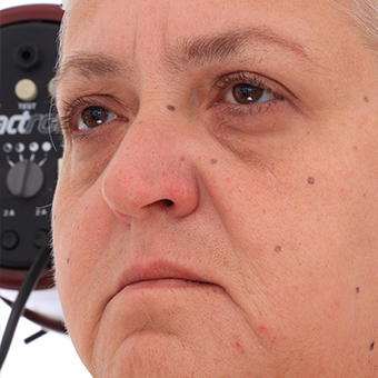 Head Woman White Bald 3D Retopologised Heads