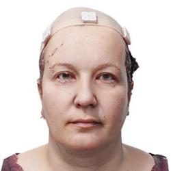 Sara John Raw Head Scan