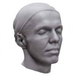 Vojta Base Head Scan