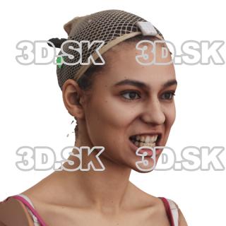 Alexia Madrid Raw Morph Scan -  Jaw Clencher Teeth