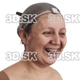 Marisol Maroto Raw Morph Scan -  Smile Open Jaw…